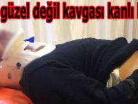 Sesin güzel değil kavgası kanlı bitti