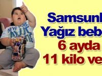 Yağız bebek 6 ayda 11 kilo verdi