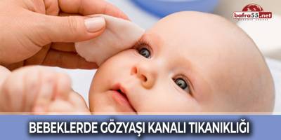 Bebeklerde Gözyaşı Kanalı Tıkanıklığı