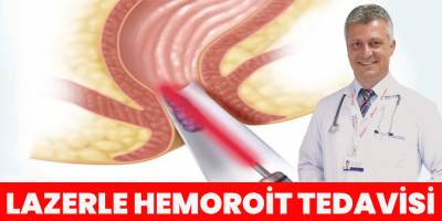 Lazerle hemoroit tedavisi