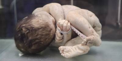 Asırlık cerrahi aletler bu müzede