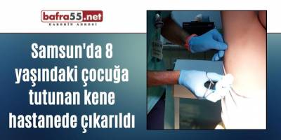 Samsun'da 8 yaşındaki çocuğa tutunan kene hastanede çıkarıldı