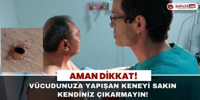 Aman Dikkat Vücudunuza Yapışan Keneyi Kendiniz Çıkarmayın