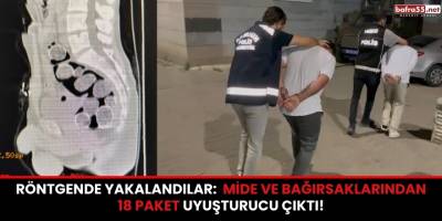 Röntgende Yakalandılar: Mide ve Bağırsaklarından 18 Paket Uyuşturucu Çıktı!
