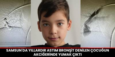 Samsun'da Yıllardır Astım Bronşit Denilen Çocuğun Akciğerinde Yumak Çıktı