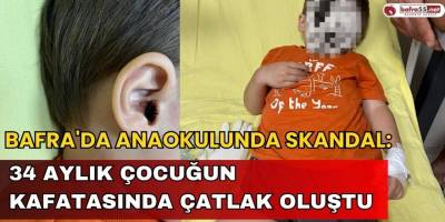 Bafra'da Anaokulunda Skandal: 34 Aylık Çocuğun Kafatasında Çatlak Oluştu