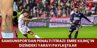 Samsunspor'dan Penaltı İtirazı: Emre Kılınç'ın Dizindeki Yarayı Paylaştılar